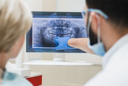 Root Canal Monmouth