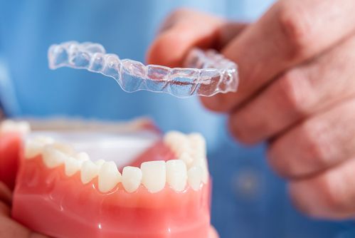 Invisalign versus Braces