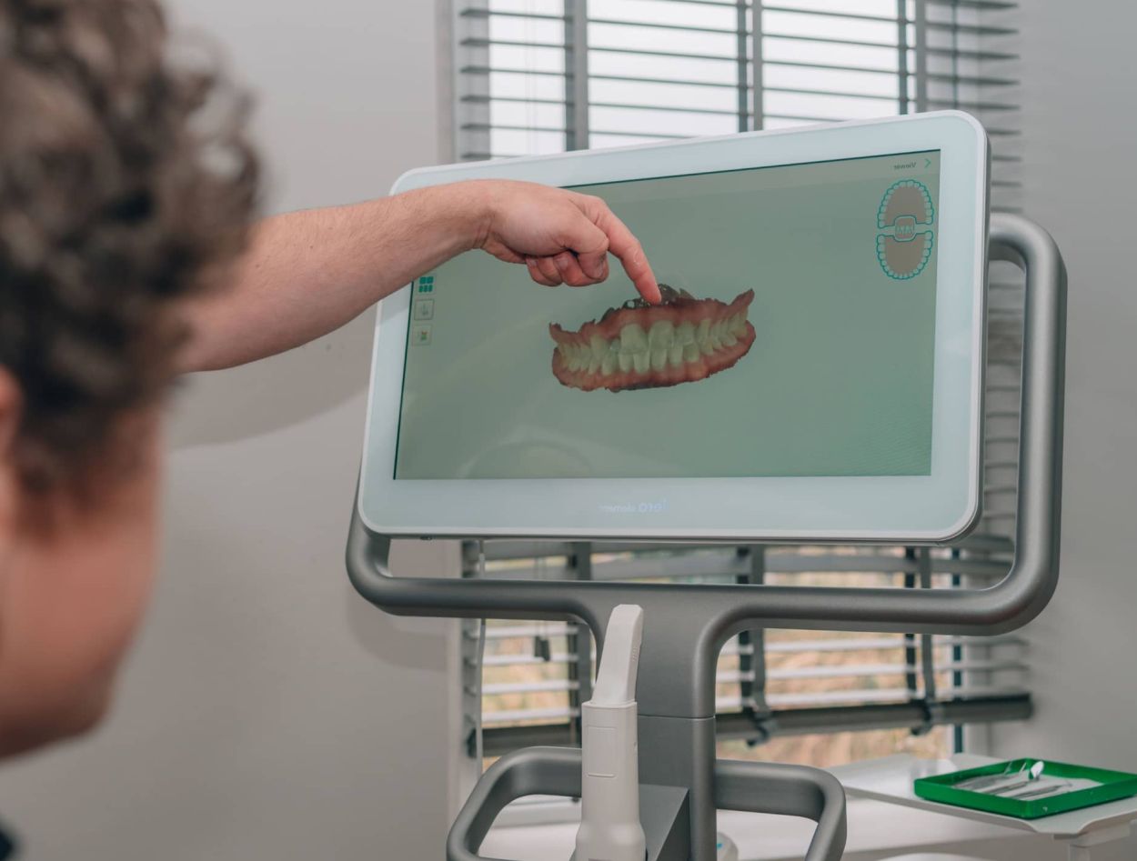 3D digital scans
