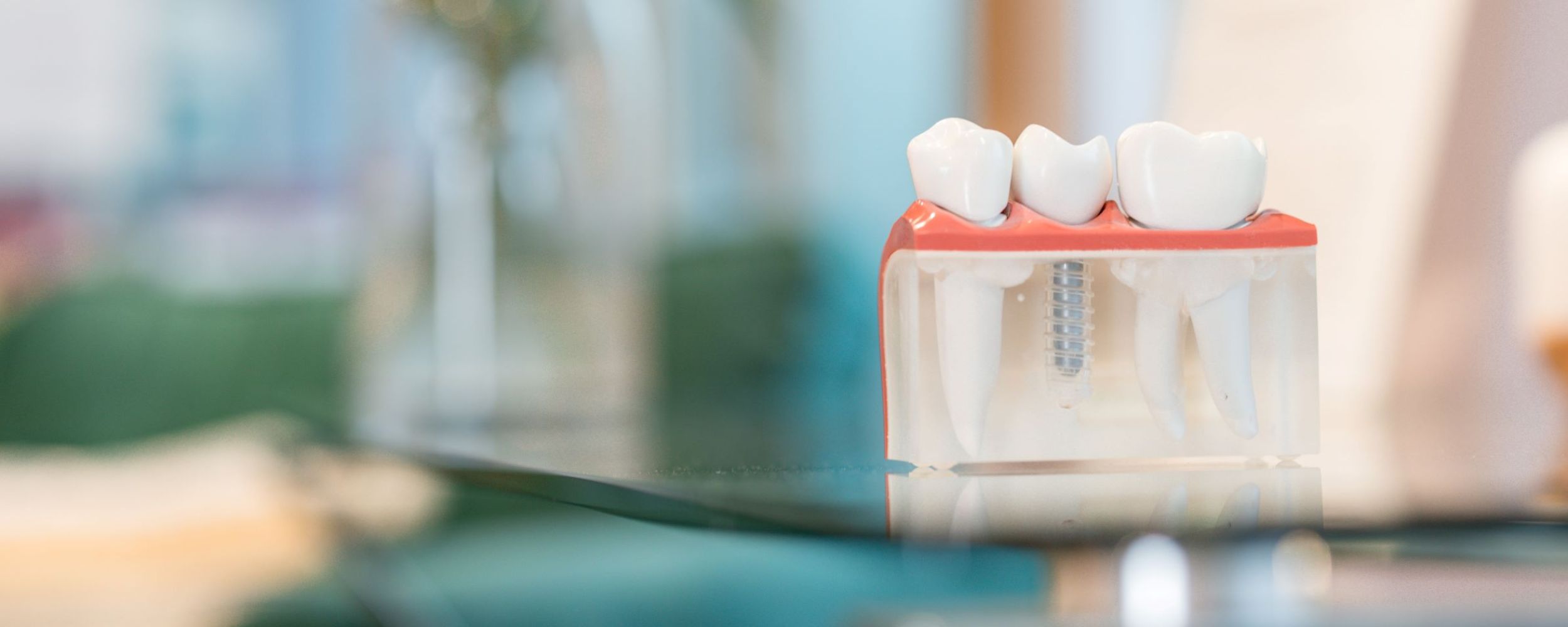Dental Implant Journey