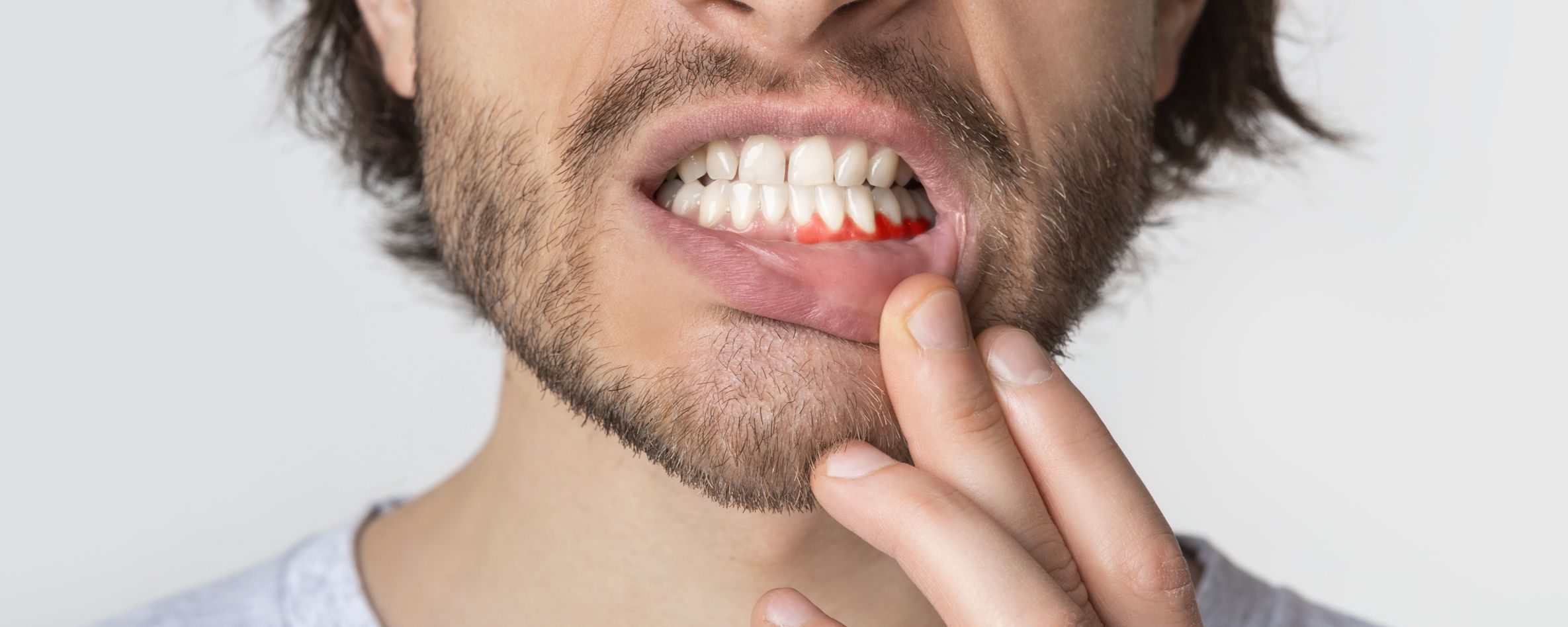 HEALTHY GUMS COULD JUST SAVE YOUR LIFE