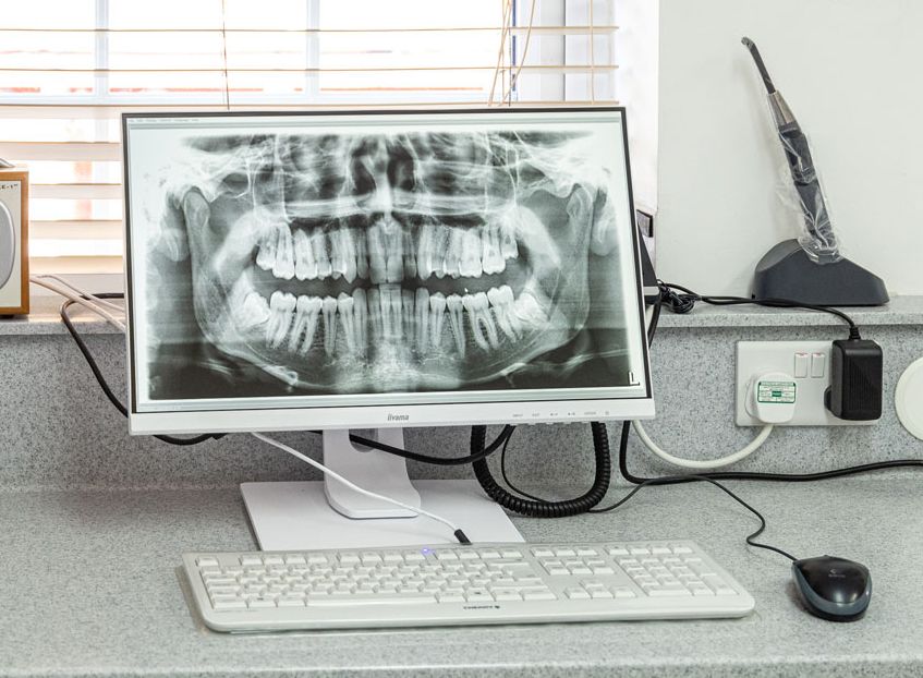 Digital x ray
