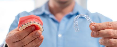 Invisalign versus Braces: Which is better suited to you?